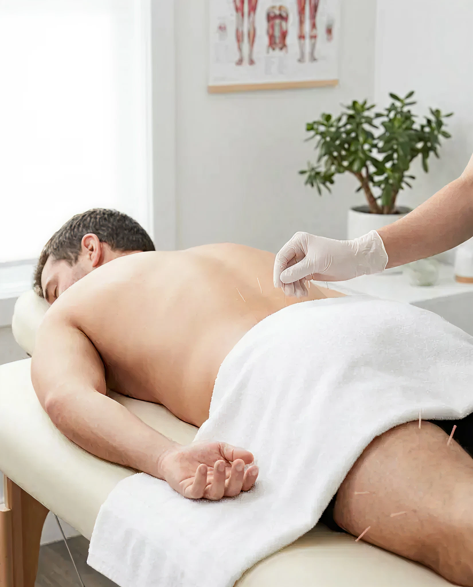 Acupuncture Wellness